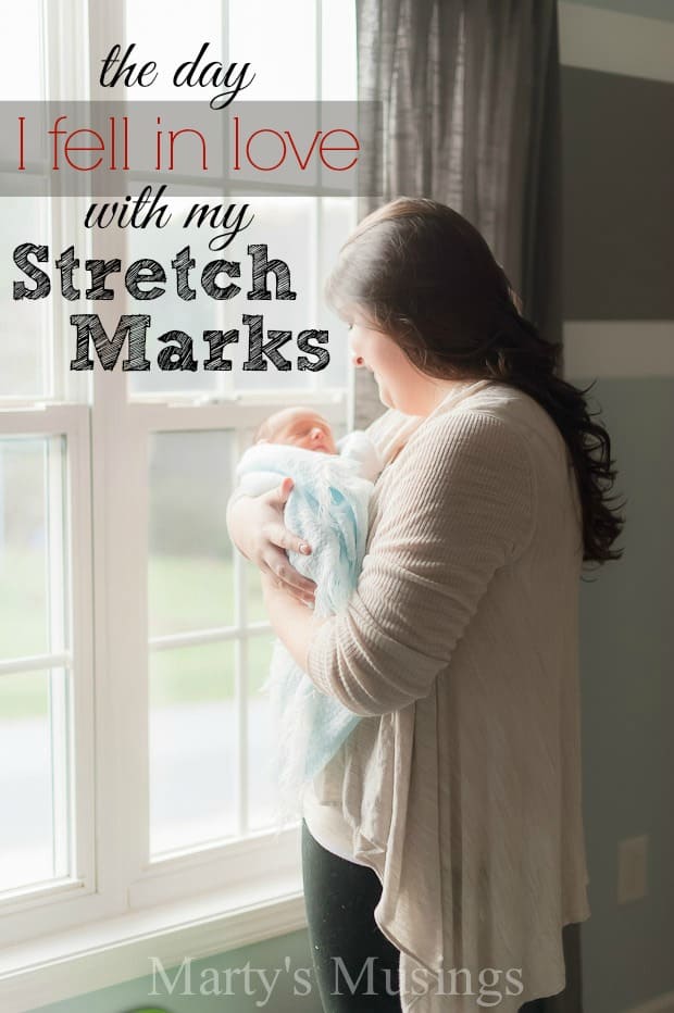 Struggling with body image after giving birth, a first time mom encourages women to embrace the beauty and gift in those pregnancy stretch marks.